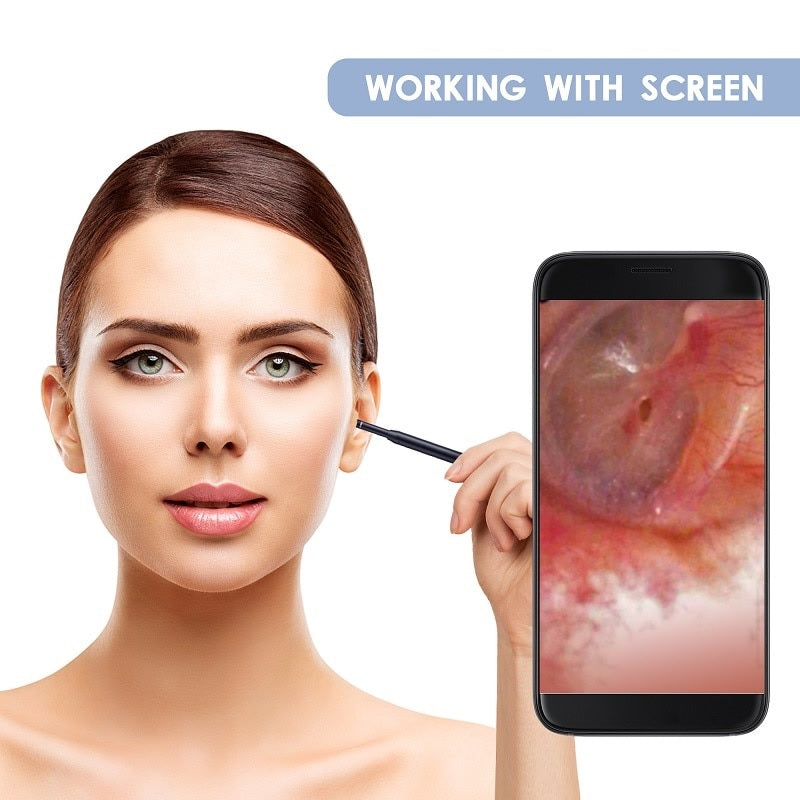 Buy Ear Cleaning Otoscope Camera 5.5MM 3in1 - Examine and Clean Ears Easily - Electromann SA