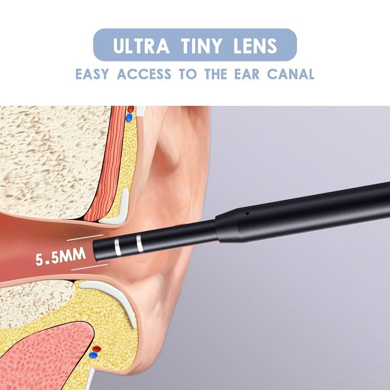 Buy Ear Cleaning Otoscope Camera 5.5MM 3in1 - Examine and Clean Ears Easily - Electromann SA