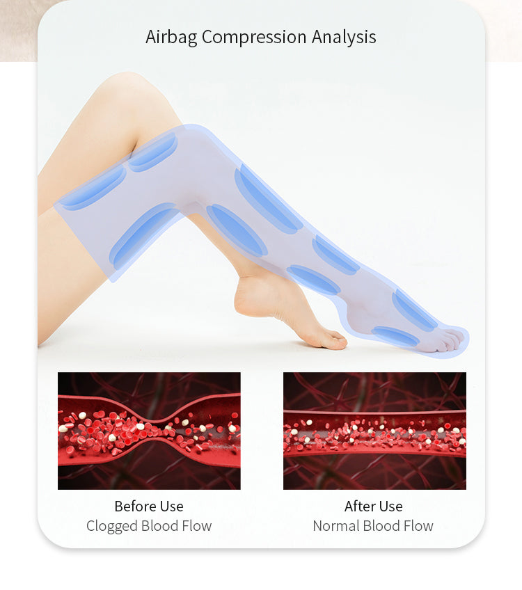 Air Pressure Leg Massager - Promote Blood Circulation and Relieve Leg Fatigue - Electromann SA
